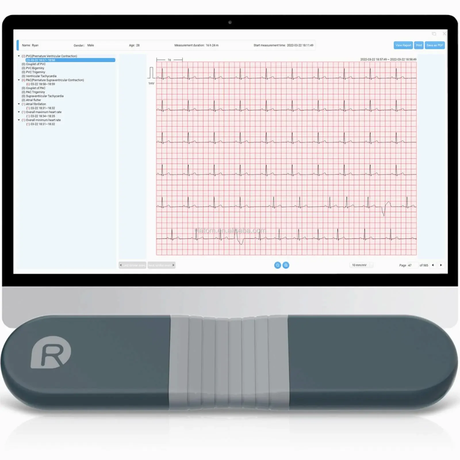 Drahtloser Bluetooth-Dynamikre – Ecg Patch Monitor Bewertung und Preis